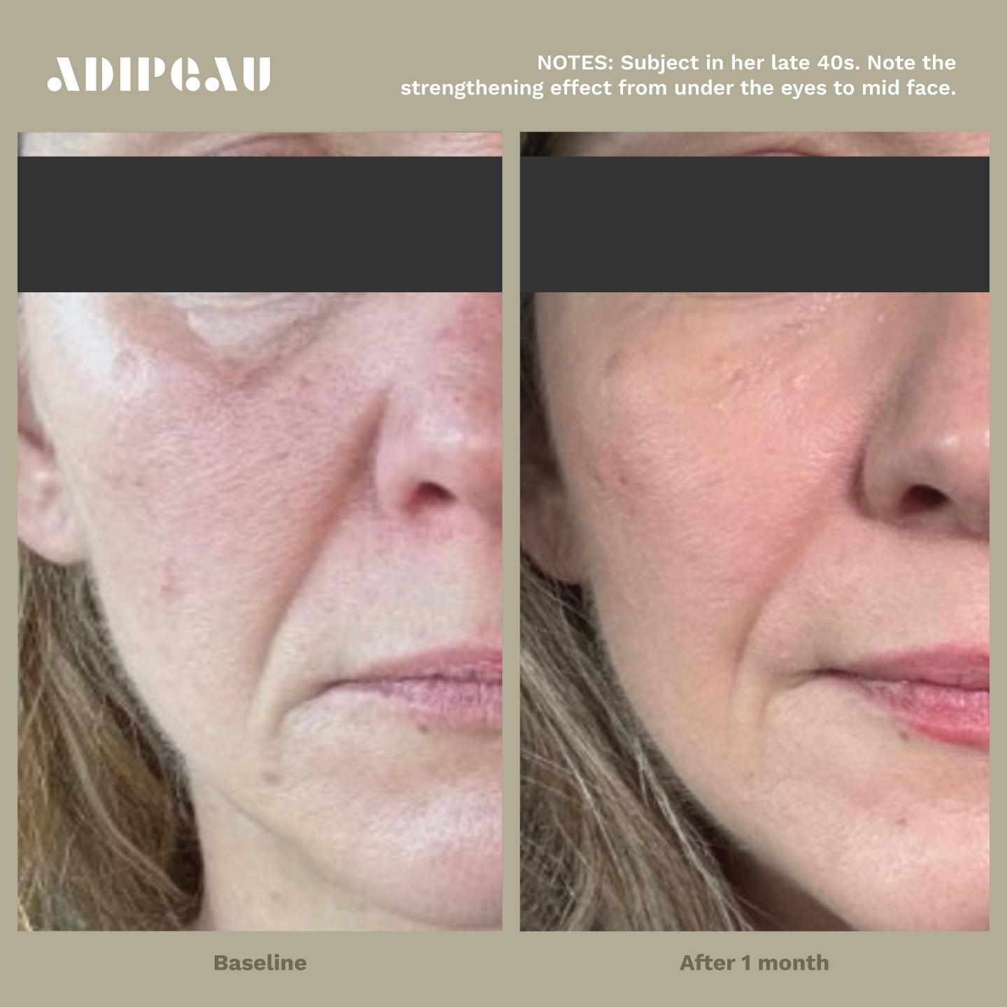 Strong Body Gel