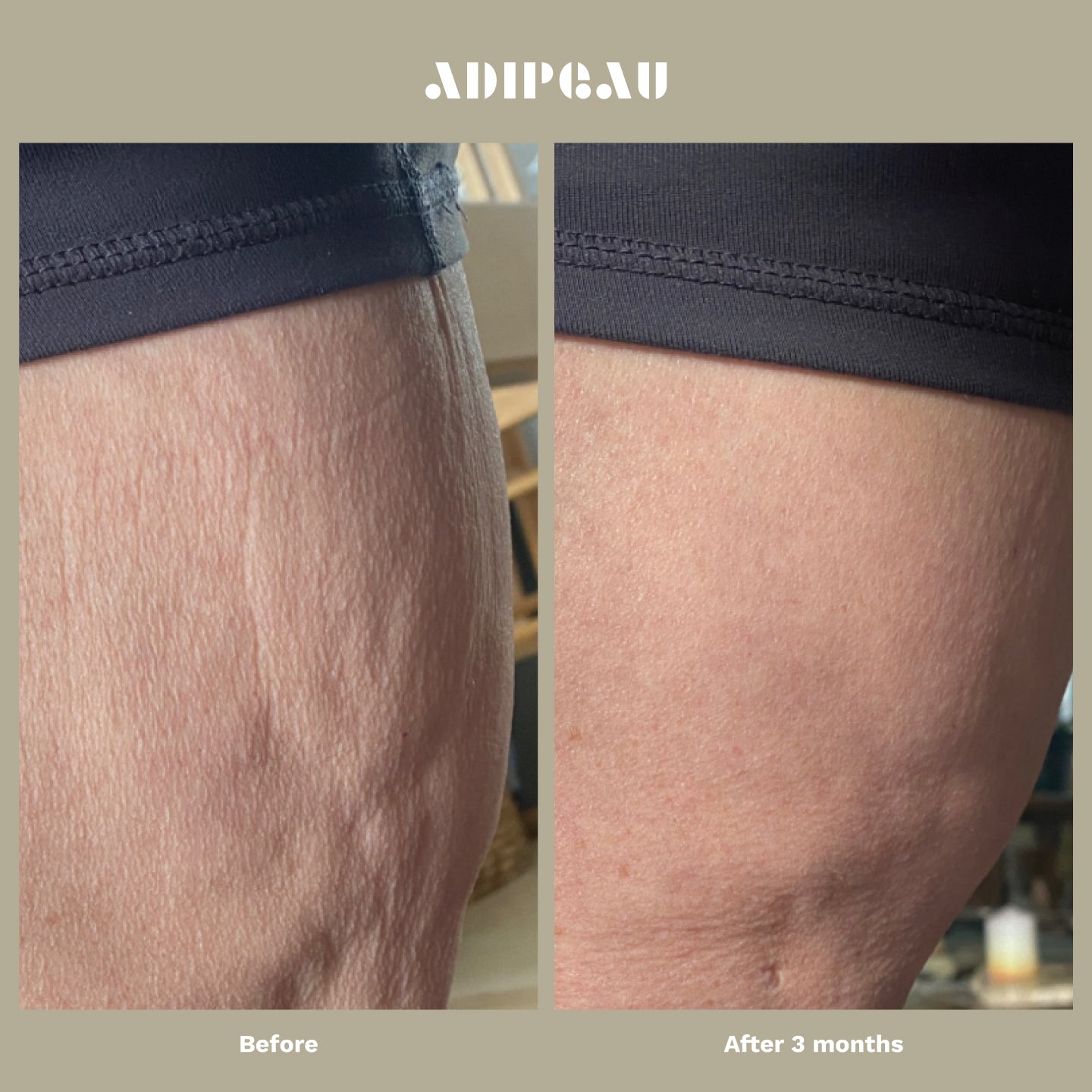 Strong Body Gel