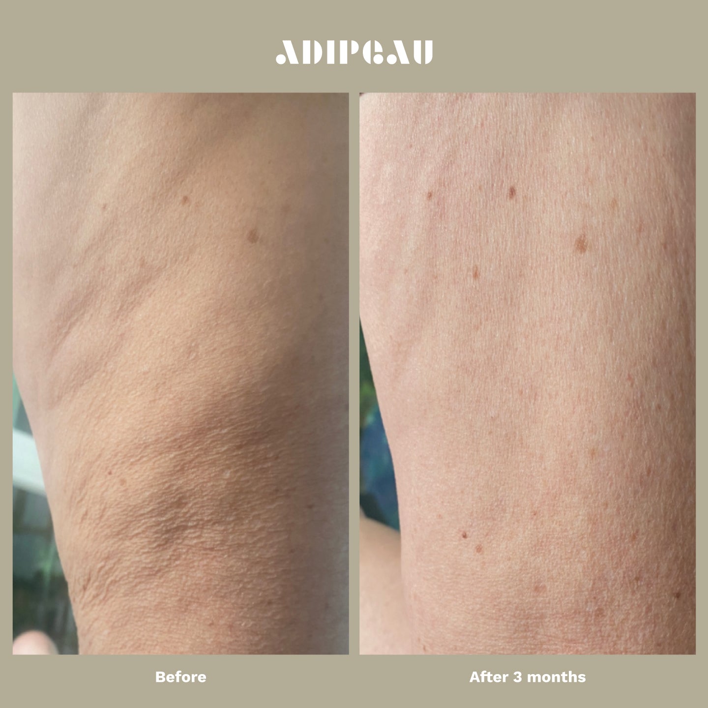 Strong Body Gel