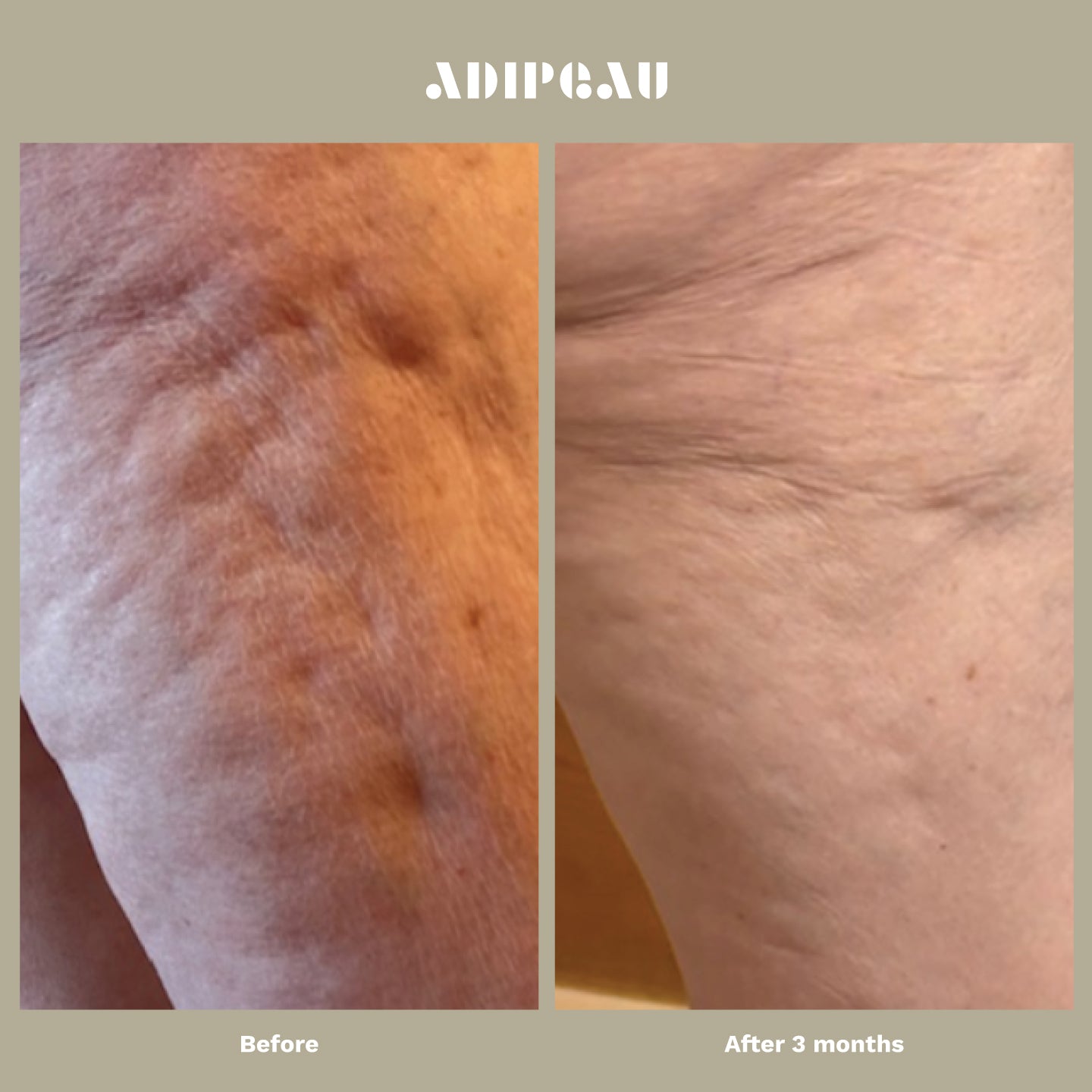 Strong Body Gel