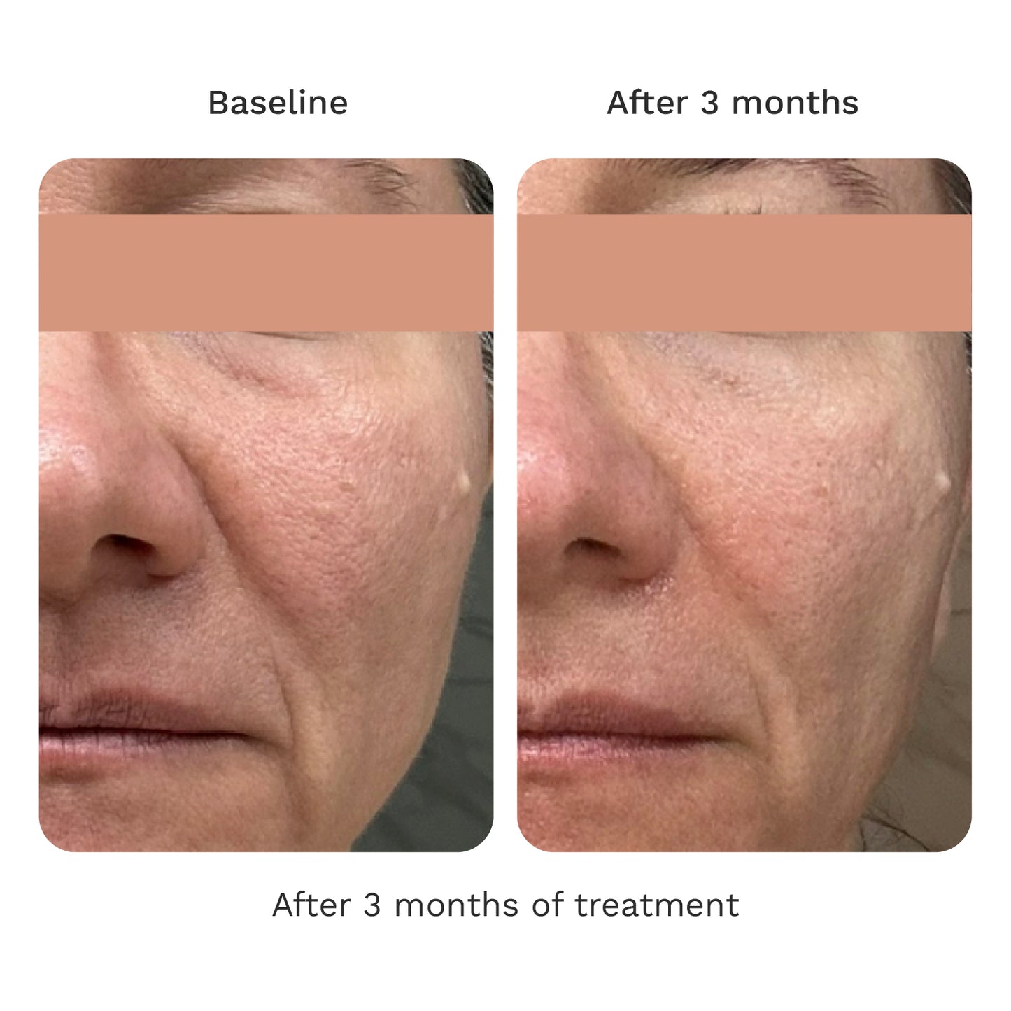 Volume Cream