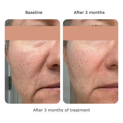 Volume Cream