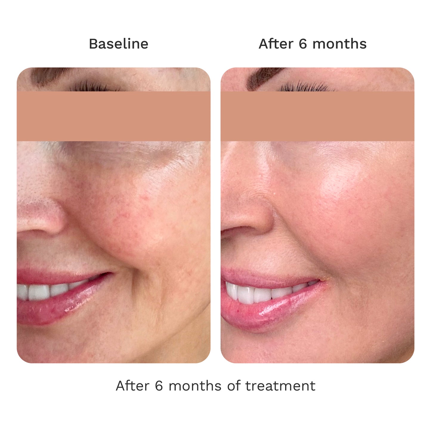 Volume Cream