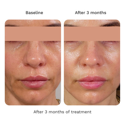 Volume Cream