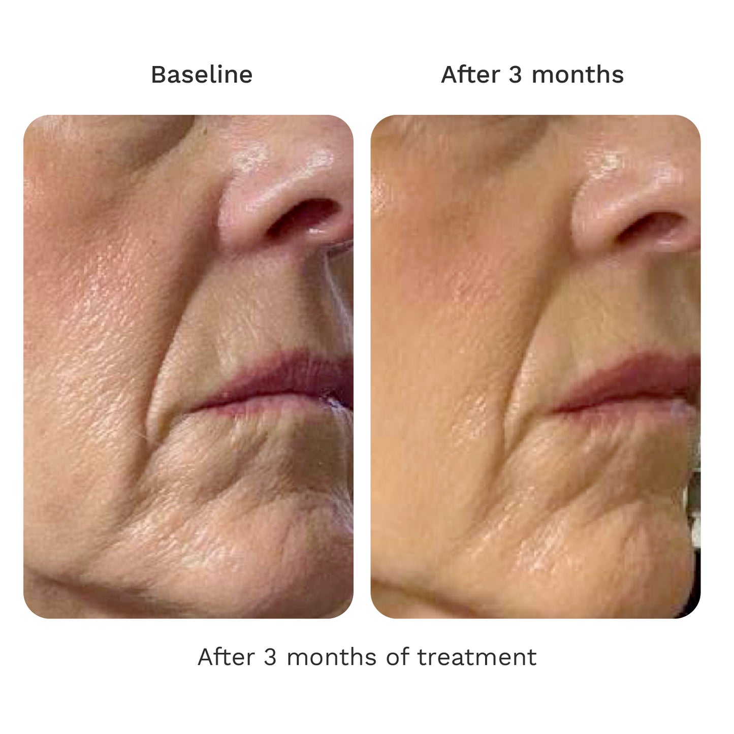 Volume Cream