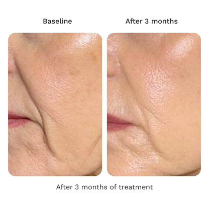 Volume Cream